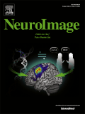 Statistical estimation of T1 relaxation time using conventional magnetic resonance imaging